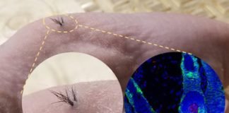 Científicos estadounidenses han conseguido hacer crecer pelo en la piel a partir de células polipotentes.