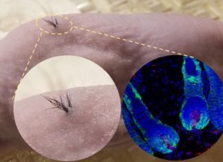 Científicos estadounidenses han conseguido hacer crecer pelo en la piel a partir de células polipotentes.