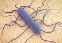 «El peor brote de LISTERIOSIS que ha sufrido España», síntomas, alimentos implicados y todo lo que necesitas saber