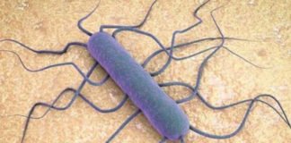 «El peor brote de LISTERIOSIS que ha sufrido España», síntomas, alimentos implicados y todo lo que necesitas saber