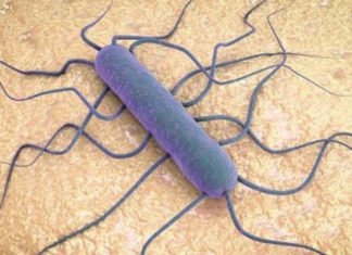 «El peor brote de LISTERIOSIS que ha sufrido España», síntomas, alimentos implicados y todo lo que necesitas saber