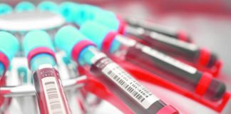 Un nuevo análisis de sangre podrá predecir quién morirá en los próximos 10 años