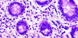 Descubren una célula inmune que abre la puerta a la «cura universal» para el cáncer