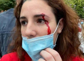 Echenique, sobre la pedrada a la diputada de Vox: «Un poco de ketchup para que se tragaran un bulo»