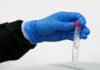 Investigadores de la UB afirman haber hallado restos de coronavirus en aguas residuales de Barcelona de marzo de 2019