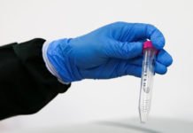 Investigadores de la UB afirman haber hallado restos de coronavirus en aguas residuales de Barcelona de marzo de 2019