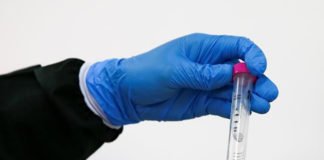 Investigadores de la UB afirman haber hallado restos de coronavirus en aguas residuales de Barcelona de marzo de 2019