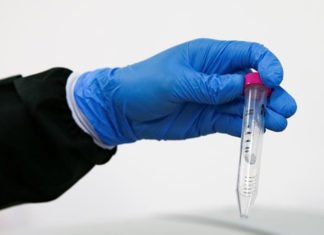 Investigadores de la UB afirman haber hallado restos de coronavirus en aguas residuales de Barcelona de marzo de 2019