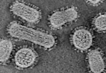 El número real de casos de coronavirus en EE.UU en marzo de 2020 estuvo muy por encima de la cuenta oficial