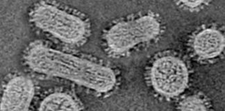 El número real de casos de coronavirus en EE.UU en marzo de 2020 estuvo muy por encima de la cuenta oficial