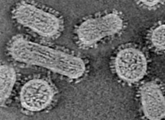 El número real de casos de coronavirus en EE.UU en marzo de 2020 estuvo muy por encima de la cuenta oficial