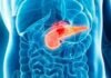 El cáncer de páncreas podría obtener tratamiento a raíz de una investigación liderada en Barcelona