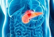 El cáncer de páncreas podría obtener tratamiento a raíz de una investigación liderada en Barcelona