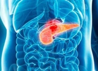 El cáncer de páncreas podría obtener tratamiento a raíz de una investigación liderada en Barcelona