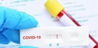 El gobierno valenciano NO recomienda los tests rápidos de anticuerpos para el autodiagnóstico