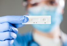 Madrid realizará a partir del día 12 de enero test a jóvenes de 18 a 29 años sin síntomas para frenar la transmisión del COVID