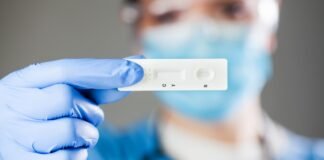 Madrid realizará a partir del día 12 de enero test a jóvenes de 18 a 29 años sin síntomas para frenar la transmisión del COVID