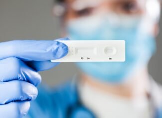 Madrid realizará a partir del día 12 de enero test a jóvenes de 18 a 29 años sin síntomas para frenar la transmisión del COVID