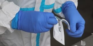 Madrid ha realizado 4.000 test serológicos en colegios para conocer la prevalencia del COVID-19