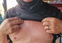 Un vecino de Benidorm operado recientemente termina en el Hospital de Villajoyosa tras ser golpeado presuntamente por un agente UPR de la Policía Nacional