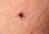 Salud lanza en Murcia recomendaciones para prevenir la Enfermedad de Lyme, que se transmite por la picadura de garrapatas