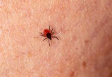 Salud lanza en Murcia recomendaciones para prevenir la Enfermedad de Lyme, que se transmite por la picadura de garrapatas