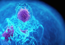 El cáncer de páncreas: el tumor más letal de España que ataca a jóvenes y deja solo un 8% de supervivientes a cinco años