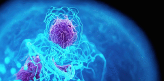 El cáncer de páncreas: el tumor más letal de España que ataca a jóvenes y deja solo un 8% de supervivientes a cinco años